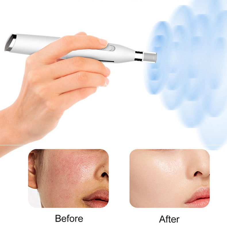 Microneedling Pen for  acne scar