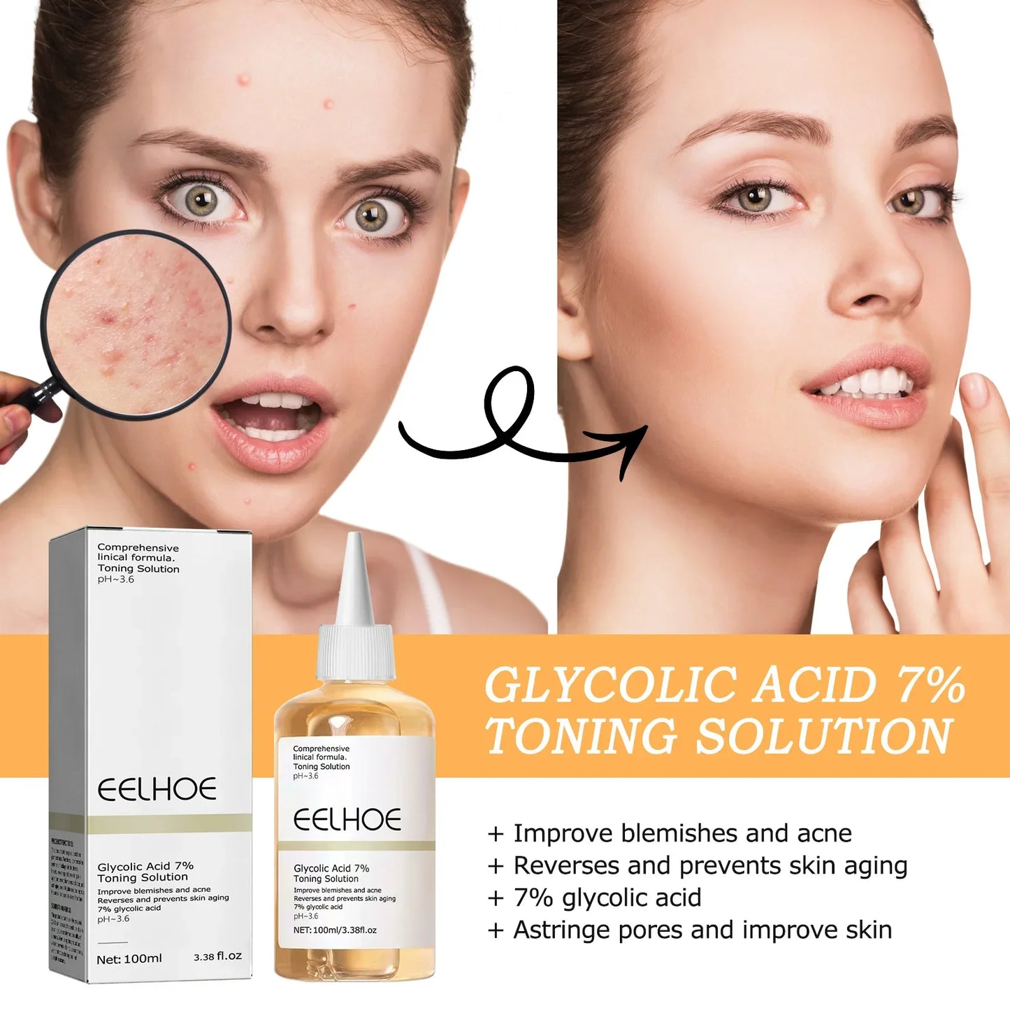 Moisturizing Whitening Glycolic Acid Shrink Pores Acne Pimple Repair Acne Scar Removing Lighten Anti Aging Soothing Serum Fluid