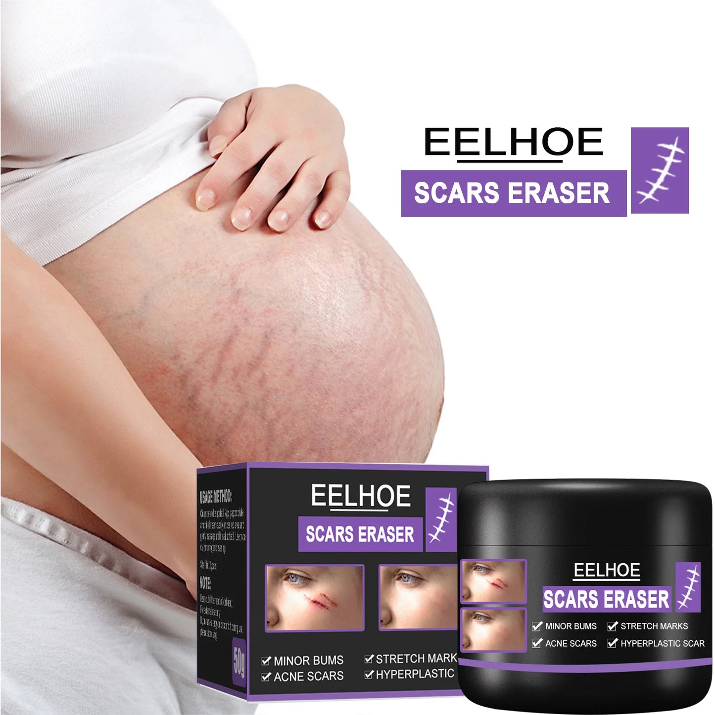 Eelhoe Scar Removal Cream Desalination Scald Burn Old Scar Pox Pit Mark Operation Scar Smoothing Skin Scar Repair Cream 50g