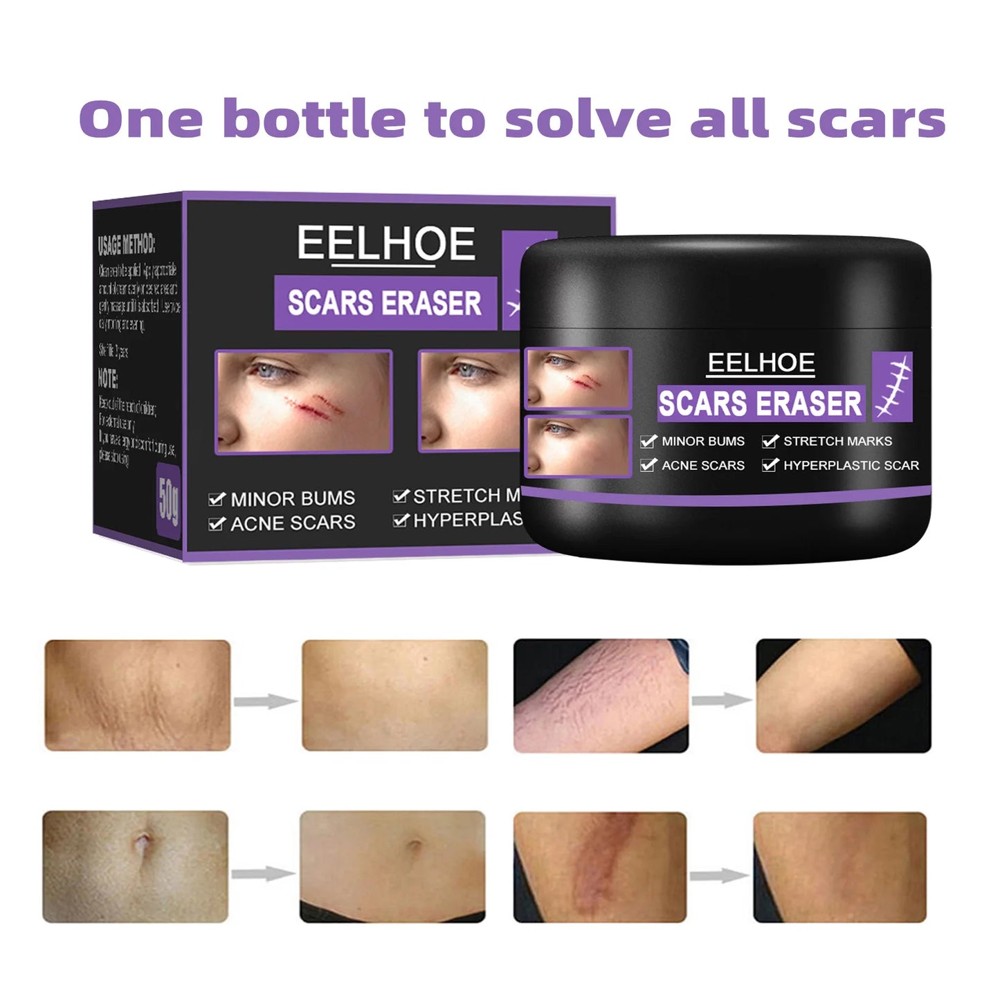 Eelhoe Scar Removal Cream Desalination Scald Burn Old Scar Pox Pit Mark Operation Scar Smoothing Skin Scar Repair Cream 50g